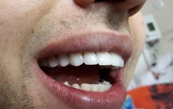 عکس طرح لبخند