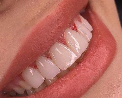 عکس طرح لبخند