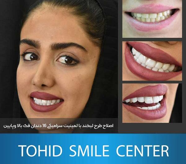 عکس طرح لبخند