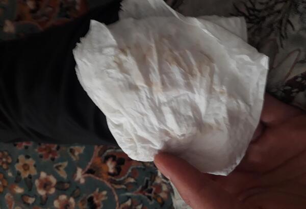 عکس انواع لکه بینی در بارداری