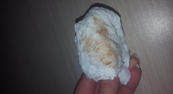 عکس لکه بینی قهوه ای بارداری