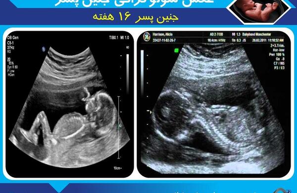 عکس نوزاد شانزده هفته