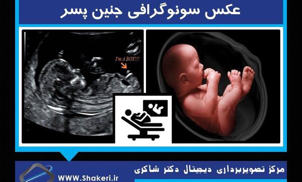 عکس غربالگری نوزاد