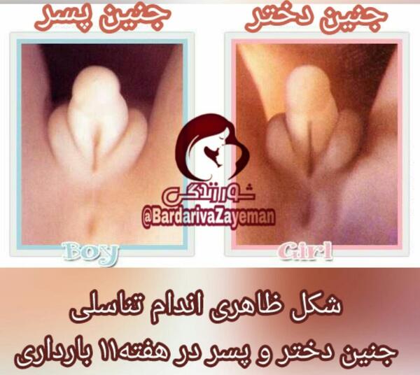 عکس جنین پسر در هفته 21 بارداری