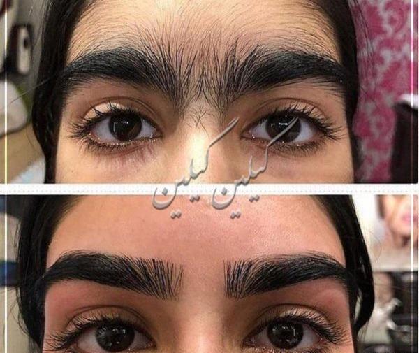 عکس های خنده دار قبل و بعد