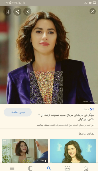 عکس ییلدیز در سریال سیب ممنوعه قبل از عمل