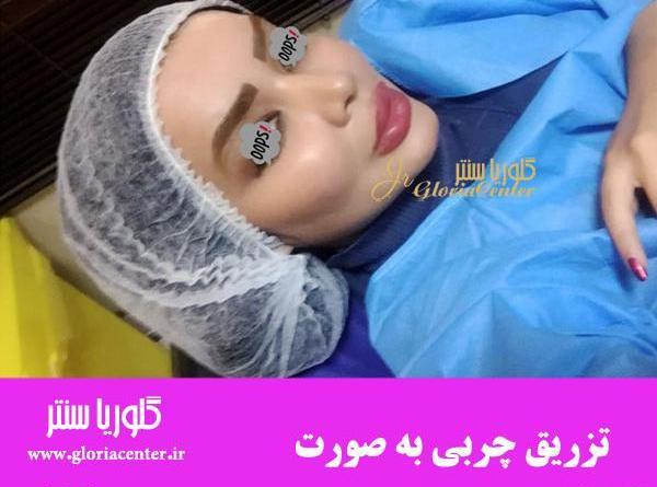 عکس کبودی صورت بعد از تزریق چربی