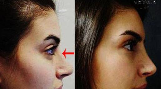 عکس کودکی دنیز بایسال