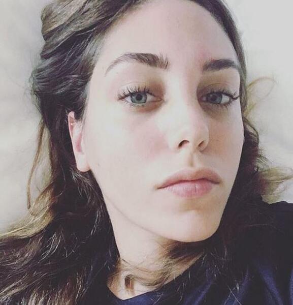 عکس اویکو کارایل قبل از عمل