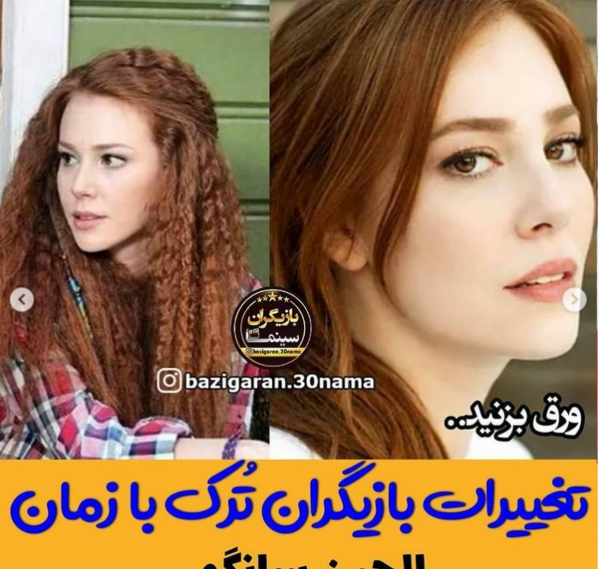 عکس قبل عمل الچین سانگو