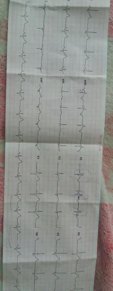 عکس فیک نوار قلب