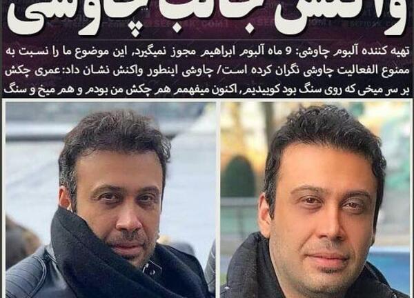 عکس محسن چاوشی قبل از عمل بینی