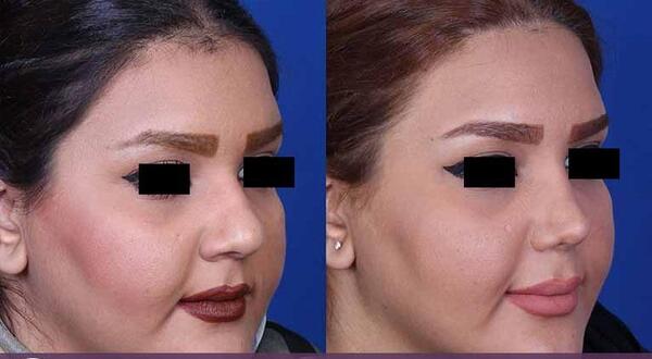 عکس ابراهیم ساریخانی