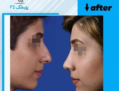 عکس ابراهیم ساریخانی