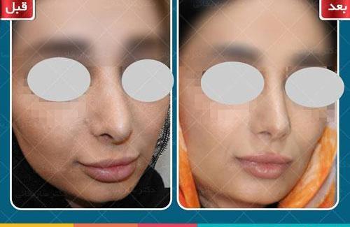 عکس ابراهیم ساریخانی