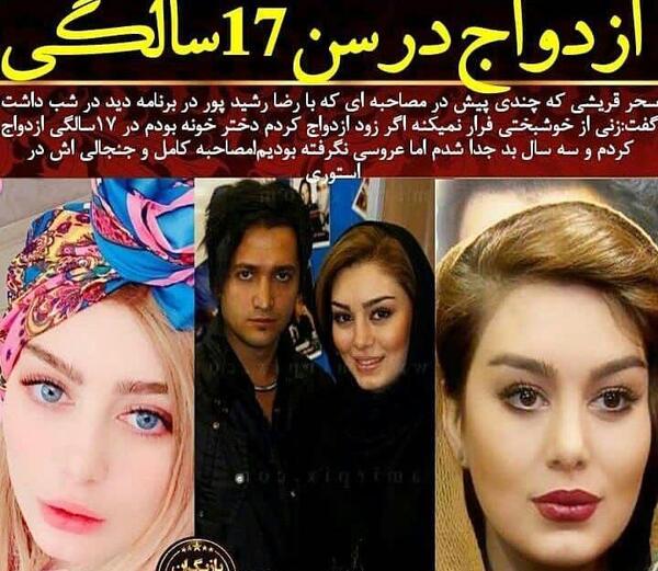 عکس قبل از عمل سحر قریشی