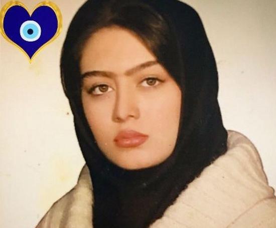 عکس قبل از عمل سحر قریشی