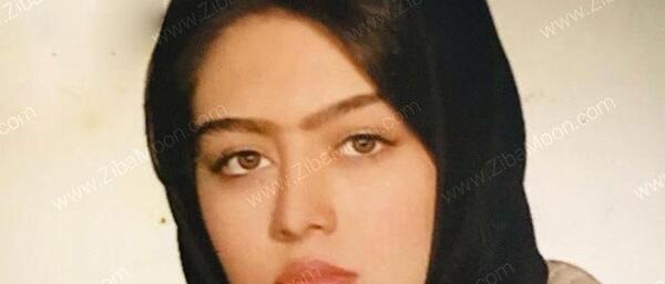 عکس قبل از عمل سحر قریشی
