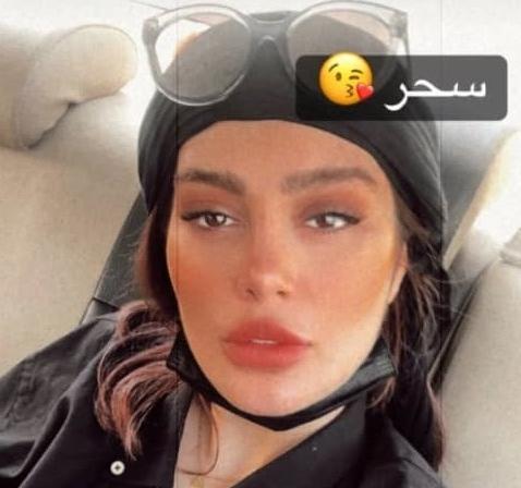 عکس قبل از عمل سحر قریشی