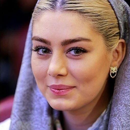 عکس قبل از عمل سحر قریشی