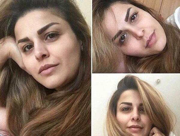 عکس قبل آرایش