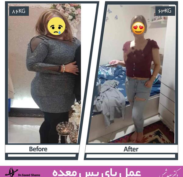 عکس قبل بعد لاغری