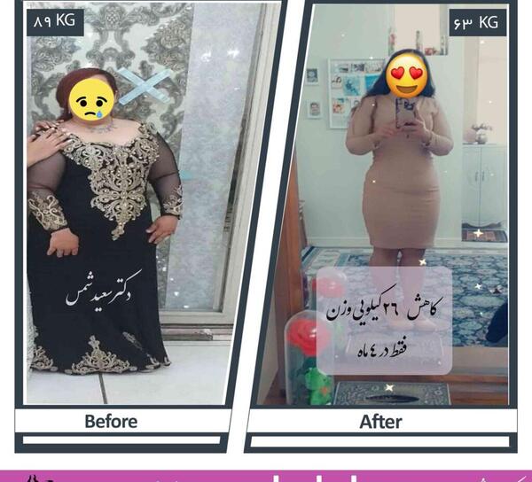 عکس قبل بعد لاغری