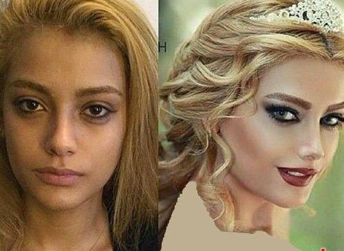 عکس قبل بعد عروس