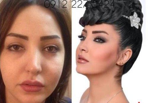عکس قبل بعد عروس