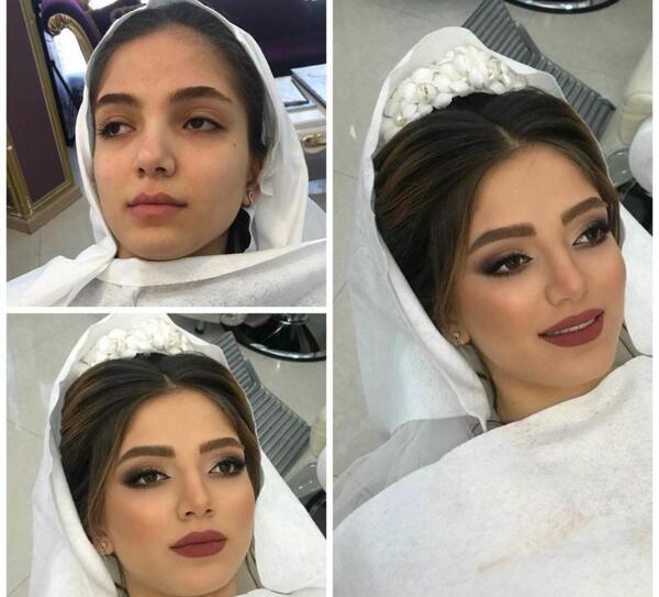 عکس قبل بعد عروس
