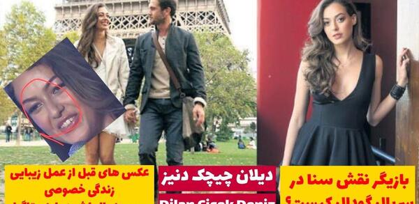 عکس ثنا قبل از عمل