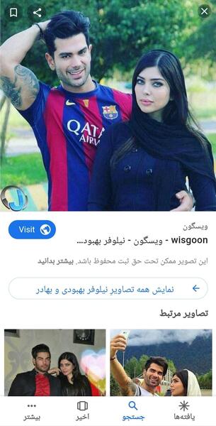 عکس ثنا قبل از عمل