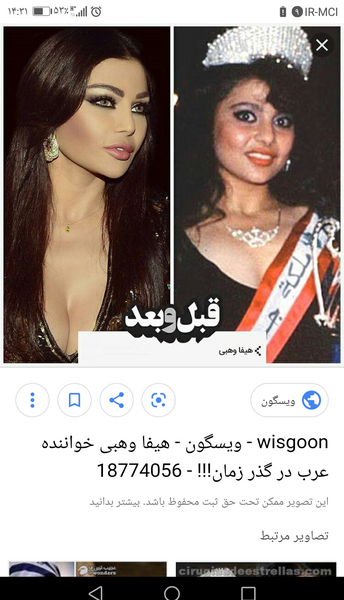 عکس قبل هیفا