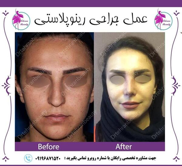 عکس دماغ قبل و بعد عمل