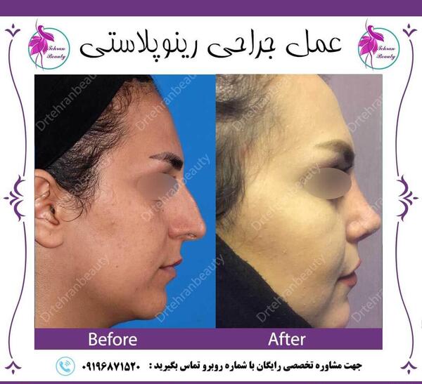 عکس دماغ قبل و بعد عمل