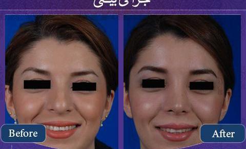 عکس دماغ قبل و بعد عمل