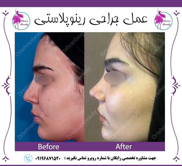 عکس دماغ قبل و بعد عمل