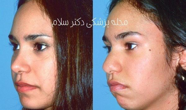عکس دماغ قبل و بعد عمل