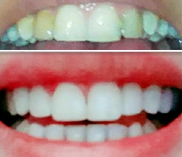 قبل عکس رنگی باید چیکار کنم نی نی سایت
