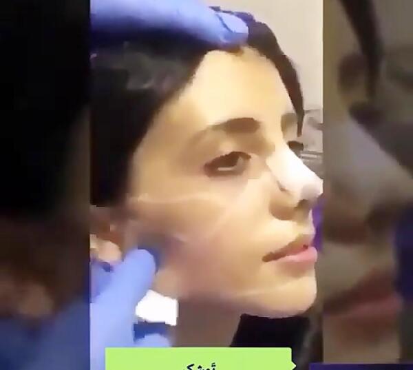 عکس قبل سحر تبر