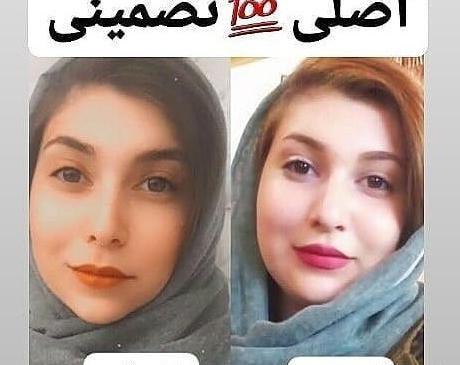 عکس صورت قبل و بعد لاغری