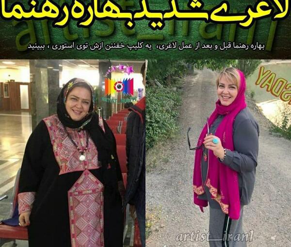 عکس صورت قبل و بعد لاغری