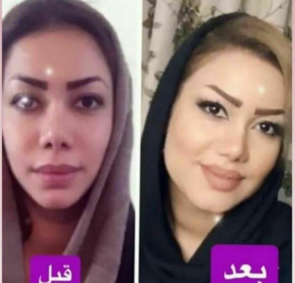 عکس صورت قبل و بعد لاغری