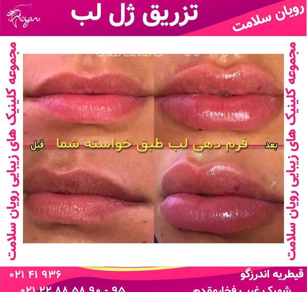 عکس صفحه قبل