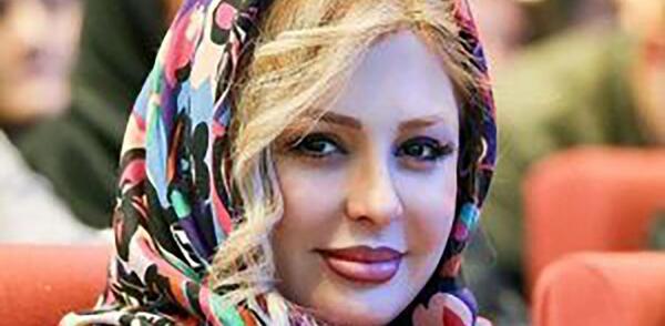 عکس نیوشا ضیغمی قبل و بعد از عمل بینی