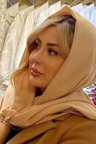 عکس نیوشا ضیغمی قبل از جراحی بینی