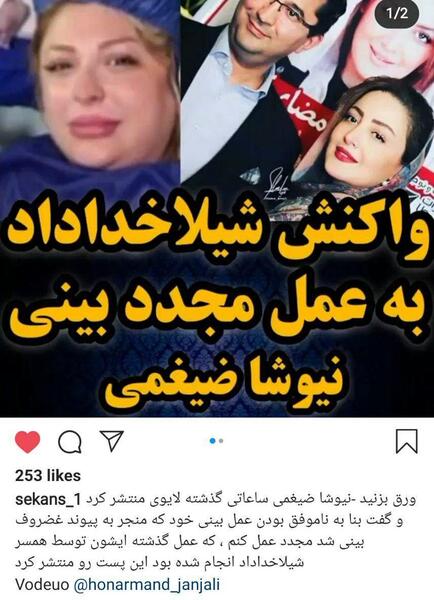 عکس نیوشا ضیغمی قبل از جراحی بینی