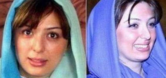 عکس نیوشا ضیغمی قبل از جراحی بینی