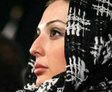 عکس نیوشا ضیغمی قبل از جراحی بینی