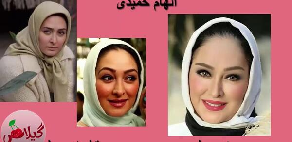 عکس قبل عمل هلال آلتینبیلک